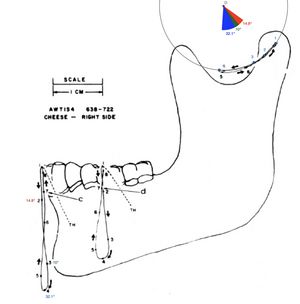 Sirignathograph rotazione asse Y.jpg