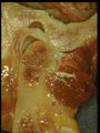 Anatomical dissection of the Temporomandibular Joint (TMJ) - Sagittal.jpg