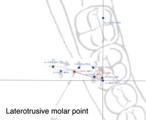 Figura Molare laterotrusivo.jpg