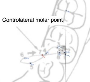 Controlateral molar point.jpeg