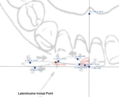 Figura 3: Rappresentazione delle distanze tra punti dell'incisivo