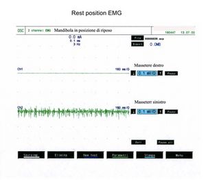 Distonic 2.jpg