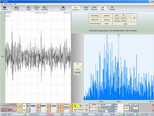 Masseter muscle Fourier trasformer.jpg