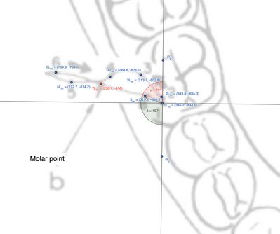 Figura 3: Rappresentazione delle distanze tra punti nel molare ipsilaterale alla laterotrusione