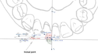 Figura 3: Rappresentazione delle distanze tra punti dell'incisivo