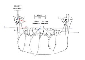 Sirognathograph frontal angle.jpg